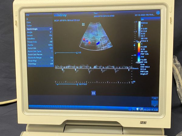MINDRAY Z6 - Imagen 5