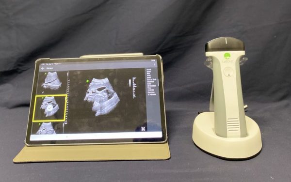 Leltech LU710C Handheld Ultrasound - Imagen 5