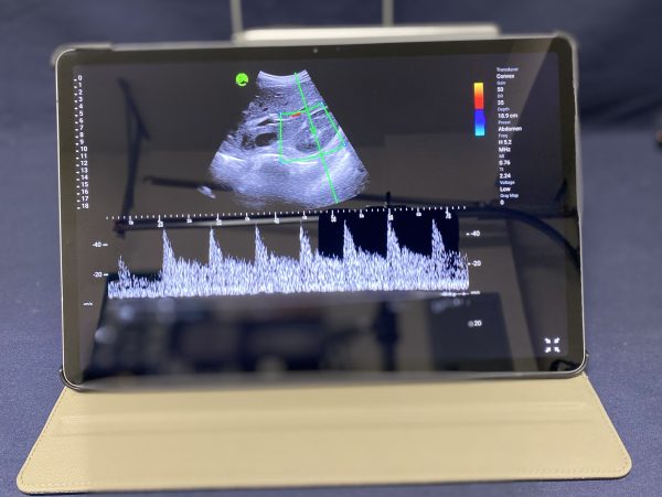 Leltech LU710C Handheld Ultrasound - Imagen 6
