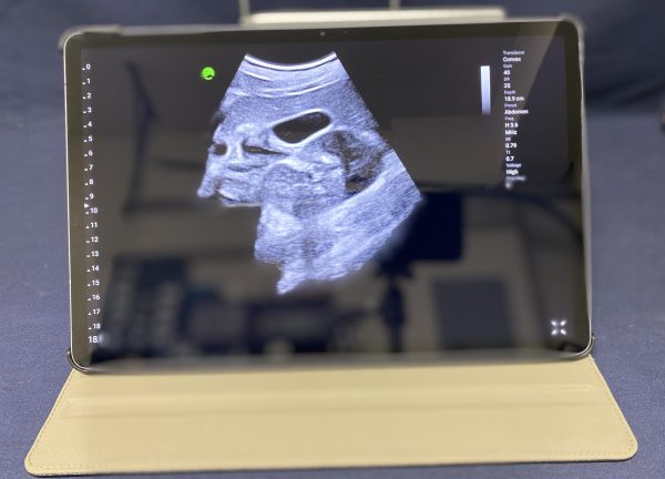 Leltech LU710C Handheld Ultrasound - Imagen 7