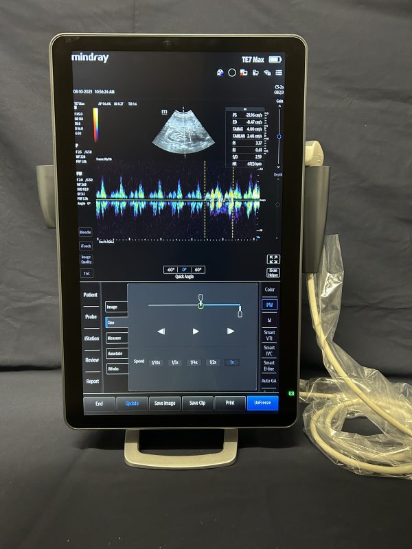 MINDRAY TE7 MAX - Imagen 3