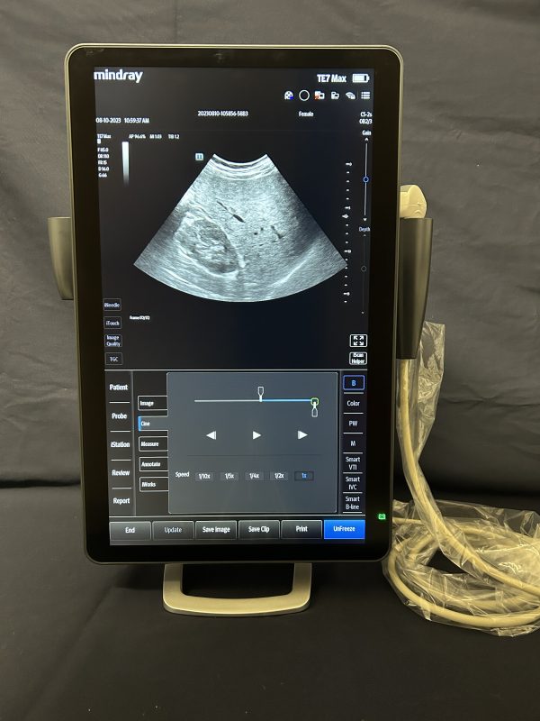 MINDRAY TE7 MAX - Imagen 4