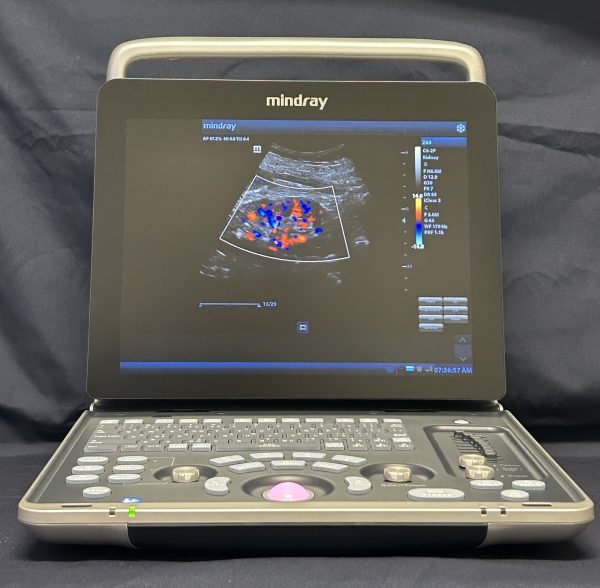 Mindray Z60