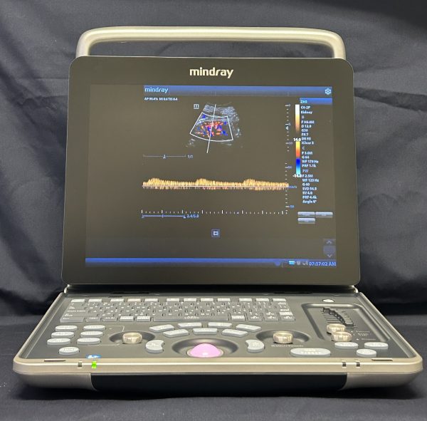 Mindray Z60 - Imagen 2