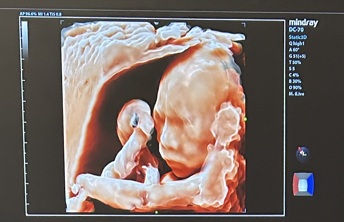 Mindray D7-2E Probe - Imagen 3