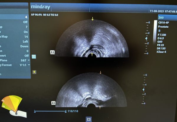 Mindray CB10-4p Probe - Imagen 3