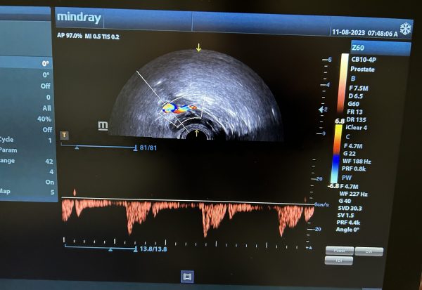 Mindray CB10-4p Probe - Imagen 4