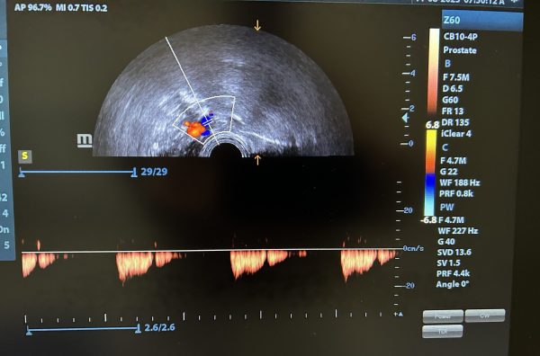 Mindray CB10-4p Probe - Imagen 5