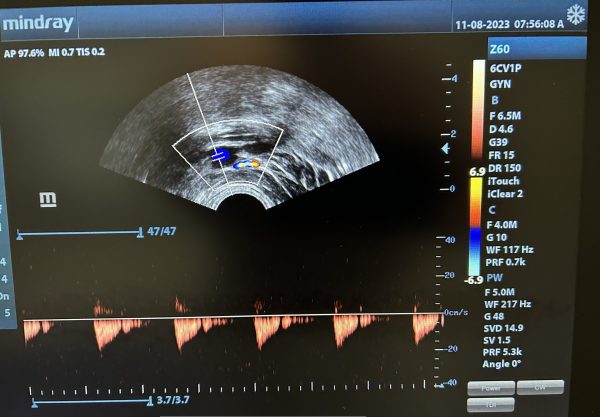 Mindray 6CV1p Probe - Imagen 3