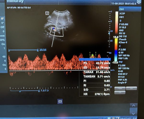 Compatible Mindray 3C5p Probe - Imagen 3